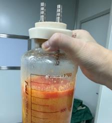 济源水动力吸脂手术要做多久？